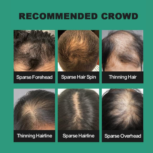 Hair Fibres for Thinning Hair - 27.5g Bottle with {Applicator} - UOYOU