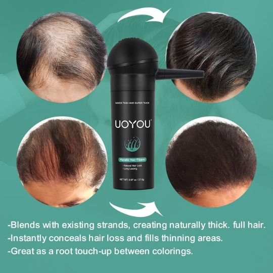 Hair Fibres for Thinning Hair - 27.5g Bottle with {Applicator} - UOYOU