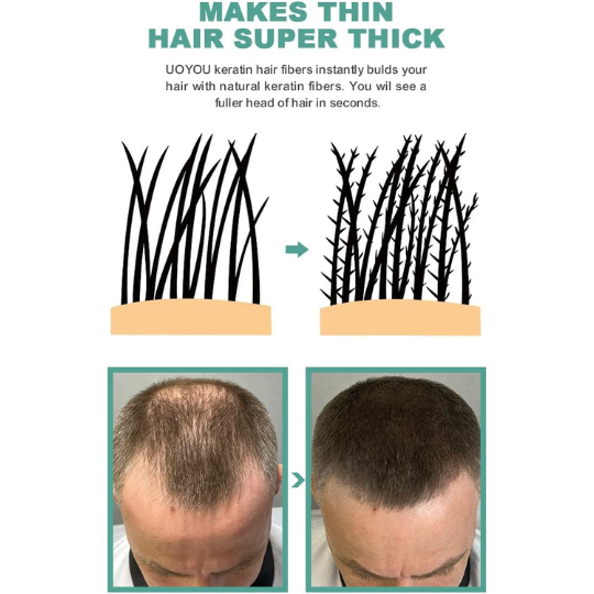 thinning hair solutions
